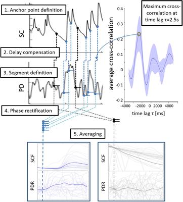 Sympathetic and Parasympathetic Modulation of Pupillary Unrest